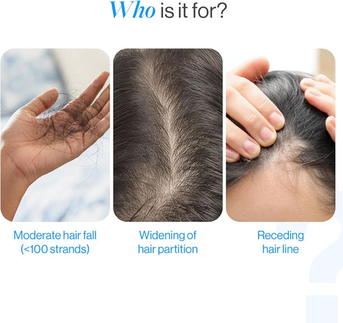 Advanced Rosemary Scalp Growth Roller